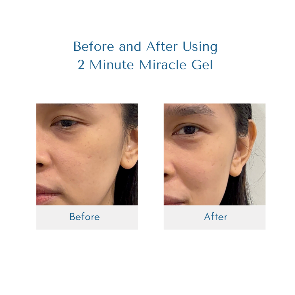 2 Minute Miracle Gel - LIPA CITY