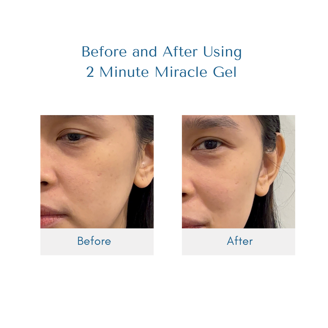 2 Minute Miracle Gel - LIPA CITY