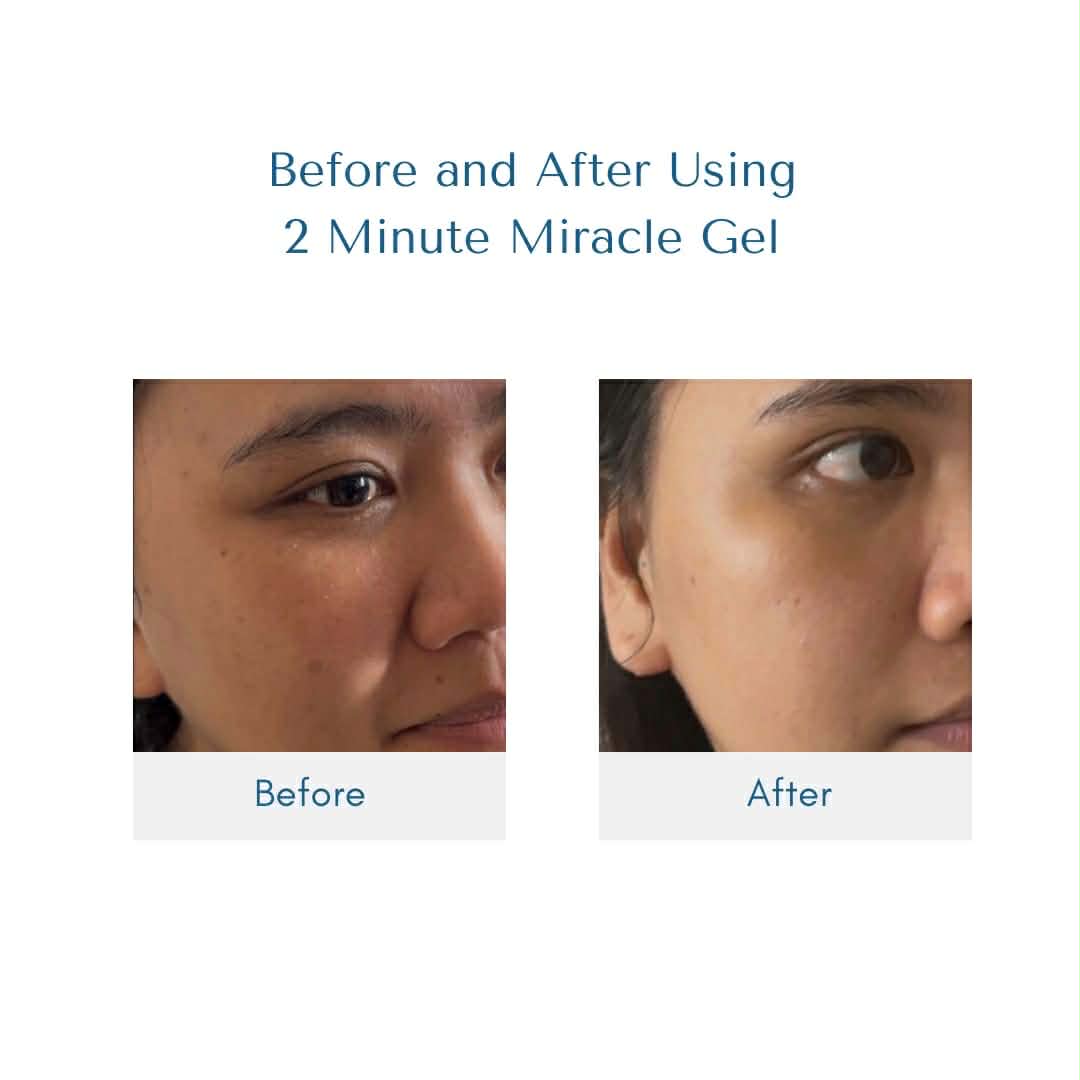 2 Minute Miracle Gel - LIPA CITY
