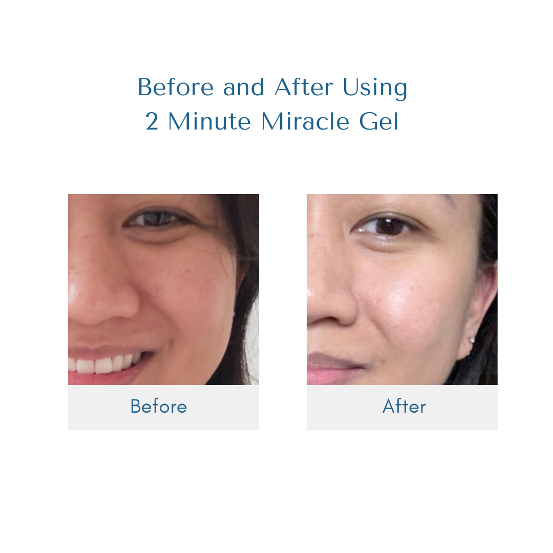 2 Minute Miracle Gel - LIPA CITY
