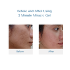 2 Minute Miracle Gel - BACOOR CITY 1