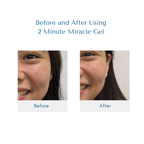 2 Minute Miracle Gel - BACOOR CITY 1